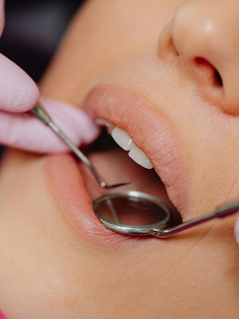 Igiene dentale Cosenza